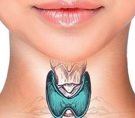 08 10 50 Mulher Tireoide 1 435x382