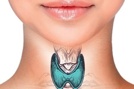 08 10 50 Mulher Tireoide 1 450x300